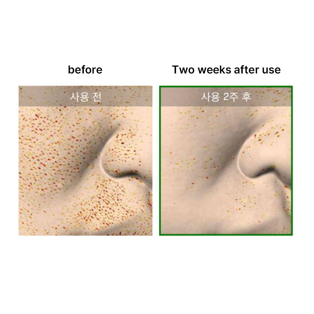 VT CICA X HYALON Reedle Shot 100 K beauty Skin Care 50mL